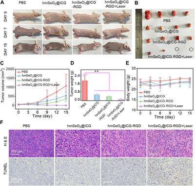 Corrigendum: Biodegradable hollowed mesoporous SeO2 nanoplatform loaded with indocyanine green for simultaneous NIR II fluorescence imaging and synergistic breast carcinoma therapy